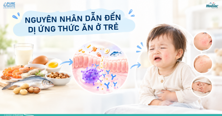 Nguyên nhân dẫn đến dị ứng thức ăn ở trẻ